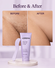 Lorena Hair Removal Cream